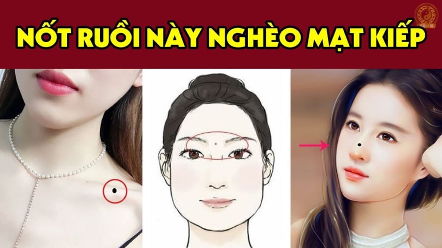 ruoi 1