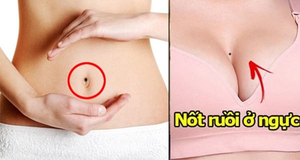 not  ruoi
