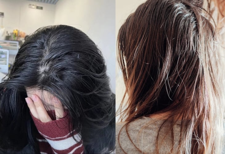 Khi nhiệt độ tăng cao, da đầu thường tiết nhiều dầu và mồ hôi hơn. 