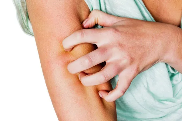 Ngứa da nhiều về đêm    