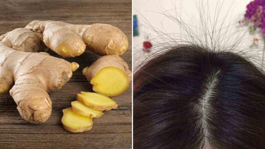 Gừng hỗ trợ mọc tóc hiệu quả