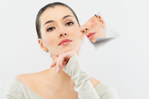 Sau khi vận động nhiều hoặc đổ mồ hôi, nên thay quần áo sớm để giữ da thông thoáng hơn.