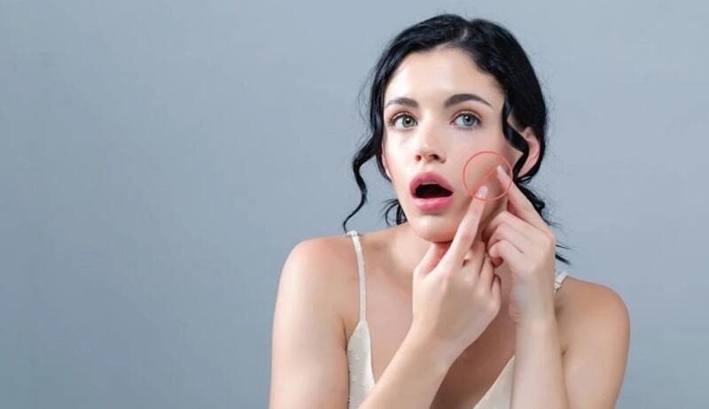 Nếu chăm sóc không phù hợp, tình trạng viêm có thể kéo dài và kích thích Sh88bet đăng ký miễn phí tăng sản sinh melanin, từ đó hình thành các vết thâm sau mụn.