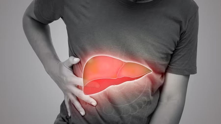 Cảnh báo bệnh gan đi vào giai đoạn nặng