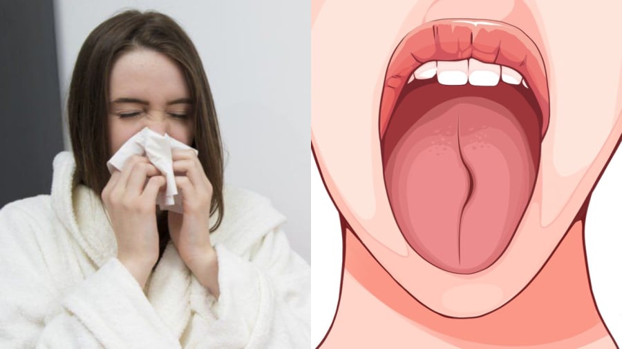 Bắt bệnh qua lưỡi