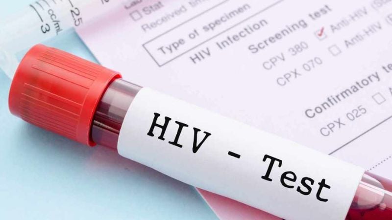 nhieu-ca-hiv-hien-nay-duoc-phat-hien-mot-cach-tinh-co