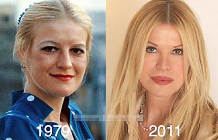 Cindy Jackson trước và sau khi Shbet888 tiền thưởng cực khủng