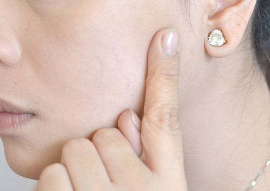 Lấy ngón tay hoặc một miếng bọt biển thoa kem nền trên khuôn mặt của bạn.