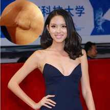 Trương Tử Lâm gầy gò và lộ sẹo dao kéo vòng 1