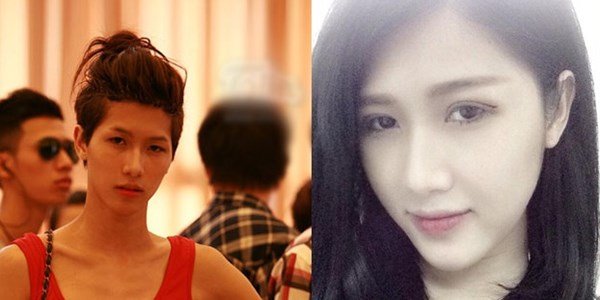 Với mong muốn được sống đúng với giới tính của mình, Trâm Anh không ngần ngại chi mạnh tay cho quá trình lột xác này.