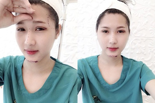 Hiện cô nàng vẫn tiếp tục chỉnh sửa khuôn mặt để trở nên nữ tính và hài hòa hơn.