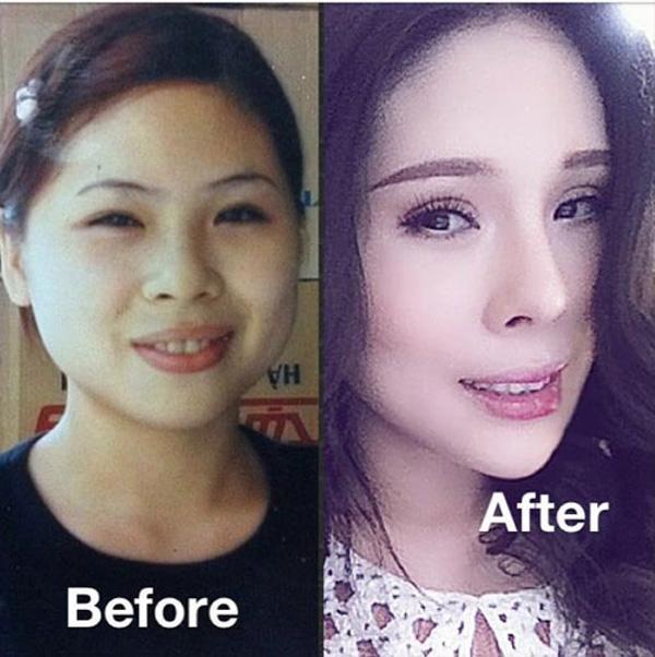 Trong suốt 9 năm, cô nàng đã trải qua biết bao nhiêu đau đớn của 12 lần Shbet888 tiền thưởng cực khủng.