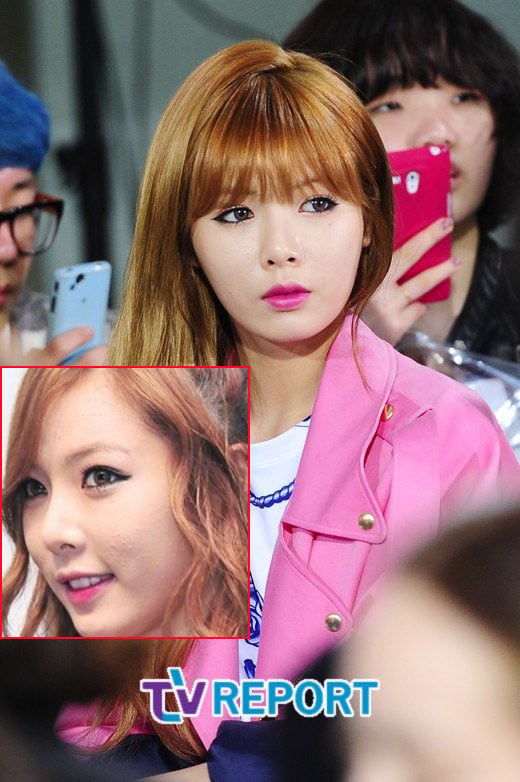 Lớp phấn trang điểm dày cộp cũng không thể nào giúp HyunA của 4minute che đi những vết sần sùi.