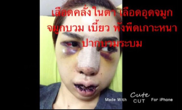 Môi, mắt, mũi đều biến dạng và khiến nhiều người choáng nặng.
