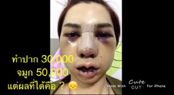 Rất may là sau một thời gian chữa trị, tình trạng tồi tệ của anh chàng này đã hết.