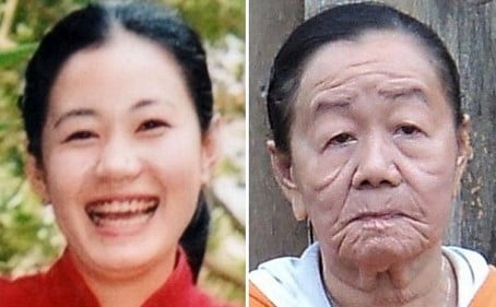 Một phụ nữ tại Bến Tre cũng bỗng chốc lão hóa.