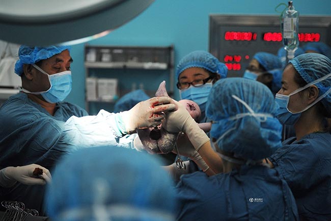 Em bé được lấy ra chỉ sau đó vài phút.
