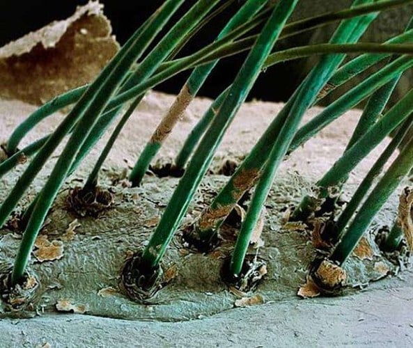Lông mi phát triển từ bề mặt của da người sẽ có hình dáng như vậy.