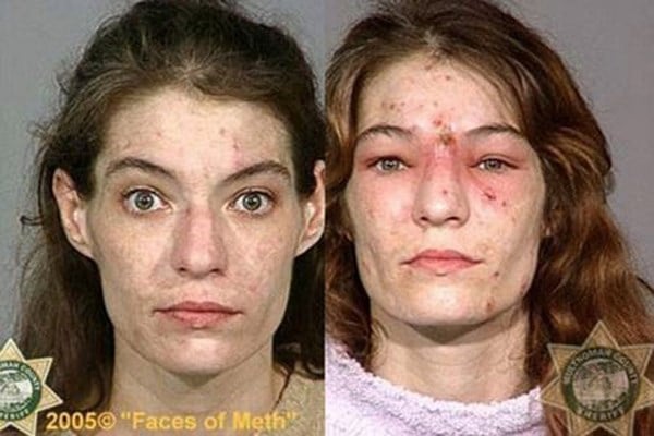 Meth là sự khởi đầu của chấm dứt và mất hết.