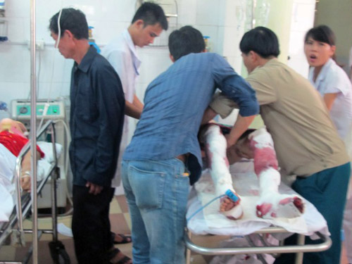 Anh Thái Viết Hảo, người trực tiếp cầm chiếc loa phát nổ bị thương nặng nhất.