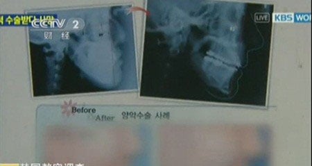 Tuy nhiên, trong quá trình Shbet888 tiền thưởng cực khủng, do sai sót của bác sĩ, người phụ nữ này đã rơi vào trạng thái hôn mê sâu. Ngay sau đó, cô đã được đưa đến phòng cấp cứu để điều trị song vẫn không thể tỉnh lại.