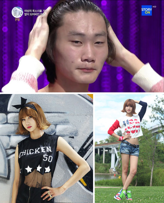Đội ngũ bác sĩ của Let Me In cho biết, tuy Jong Woong có thân hình mảnh khảnh nhưng các đường nét khuôn mặt đều góc cạnh nam tính.