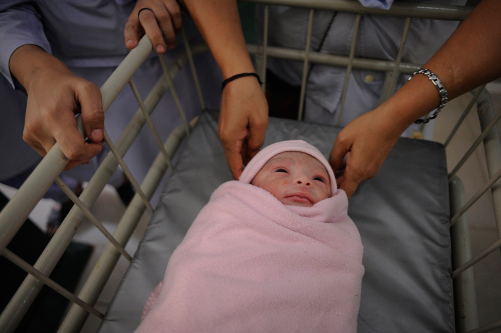 Những vệt máu đỏ trong mắt. Không phải mắt bị chảy máu mà sau khi chào đời, mẹ có thể nhận thấy những vệt máu đỏ nổi trên phần lòng trắng trong mắt bé.