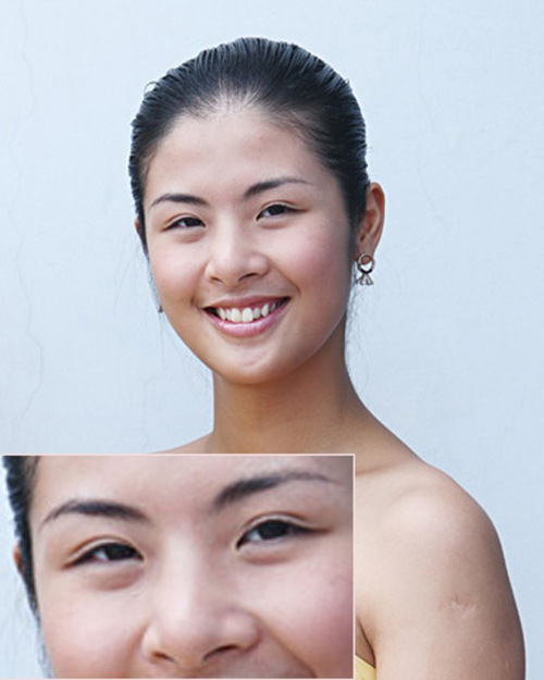 Ngọc Hân trước đây. Răng của Ngọc Hân không chỉ hơi hô mà còn mọc khấp khểnh.