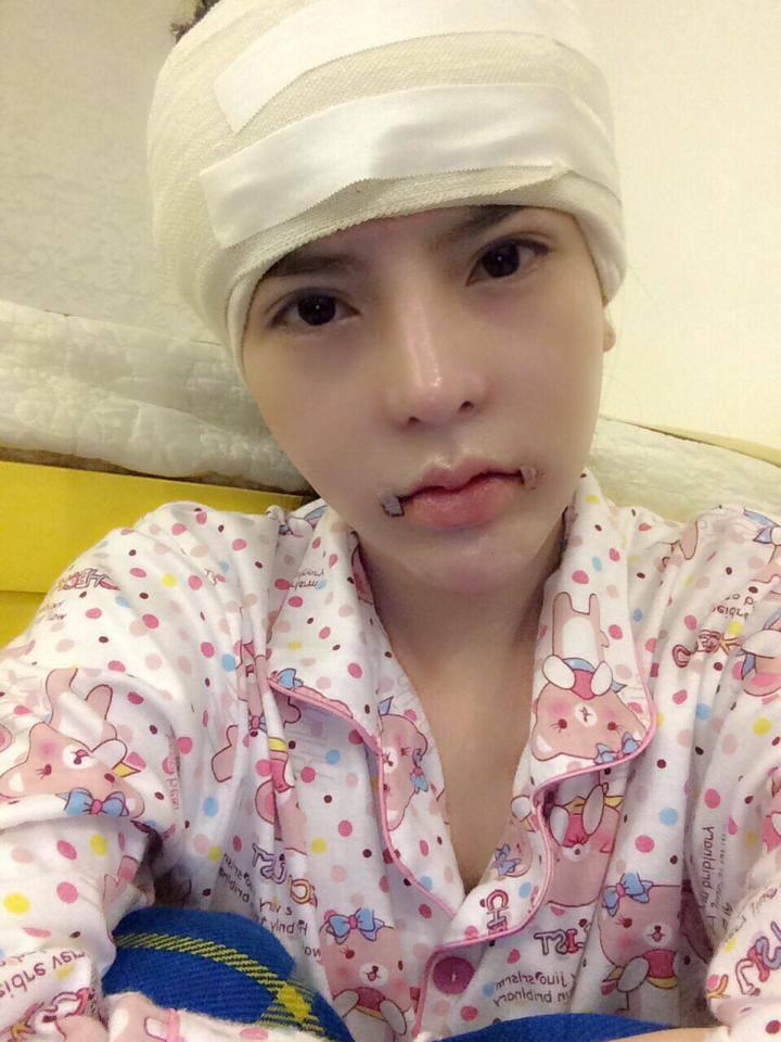Cô đã phải trải qua quá trình đau đớn để thẩm mỹ.