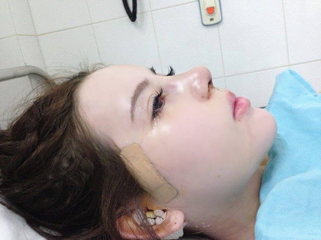 Cô đã từng nổi lên như một người nghiện thẩm mỹ.