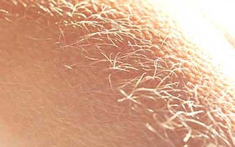 Số lượng lông trên Sh88bet đăng ký miễn phí. Con người trông có vẻ mịn màng và ít lông hơn so với các loài linh trưởng khác. Tuy nhiên, trên thực tế số lượng sợi lông trên Sh88bet đăng ký miễn phí con người ngang bằng với một con tinh tinh.