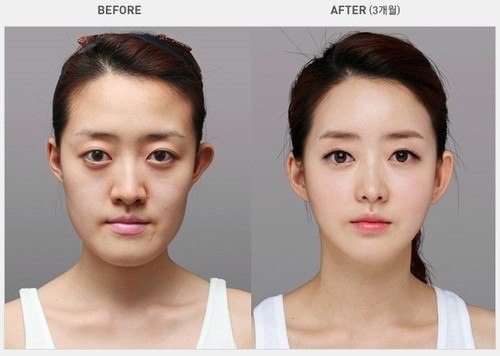 Chiếc cằm vuông dễ nhận thấy nhất của cô gái này đã được chỉnh sửa.