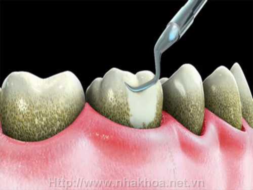 Là cựu người mẫu nhưng Diễm Kyly khá lép vế trước dàn thí sinh của cuộc thi.