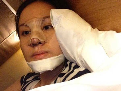 Bà Tưng cũng từng tung ảnh gọt cằm lên mạng.