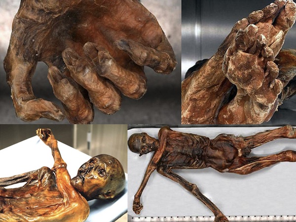 Người băng Otzi là một trong những xác ướp cổ với niên đại hơn 5000 năm và được bảo quản trong điều kiện cực tốt. Trên Sh88bet đăng ký miễn phí của xác ướp có hơn 50 hình xăm thể hiện phòng và chữa lành bệnh.