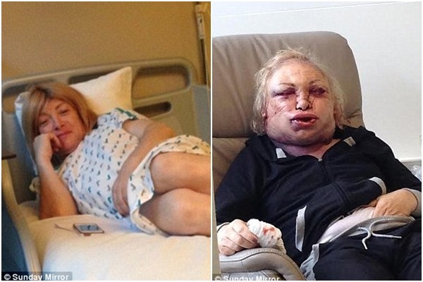 Kellie Maloney đã quyết định Shbet888 tiền thưởng cực khủng thẩm mỹ.
