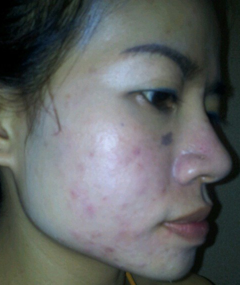 Chúng ta cần đặc biệt thận trọng khi lựa chọn mỹ phẩm.
