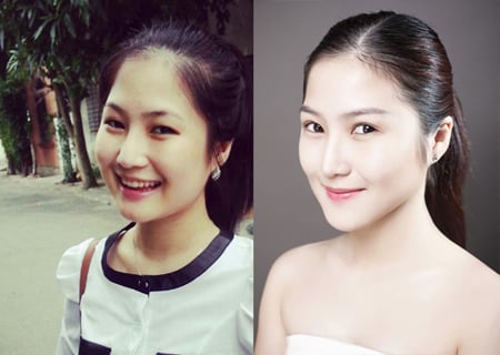 Nhưng phải thừa nhận rằng cô đã đẹp hơn rất nhiều sau Shbet888 tiền thưởng cực khủng thẩm mỹ.