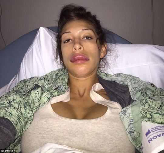 Theo trang TMZ, Farrah Abraham đã sửa môi theo cách cấy miếng đọn vào trong môi thay vì bơm như trước.