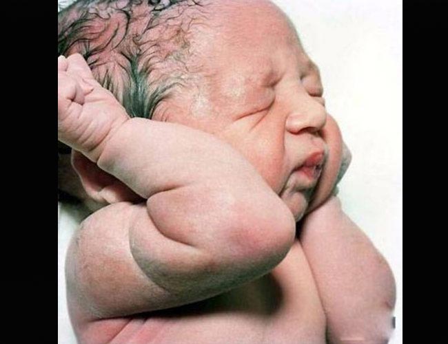 Mắt của bé vẫn còn nhắm nghiền và chưa thể mở ra ngay. Trên khóe mắt thậm chí vẫn còn rất nhiều ghèn gỉ.