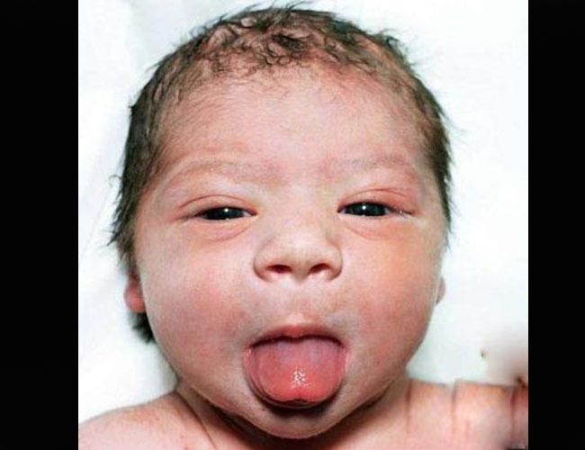 Sẽ có lúc mẹ thấy bé nhìn thẳng vào mẹ. Lại có lúc, hai mắt của bé như đi theo hai hướng khác nhau.