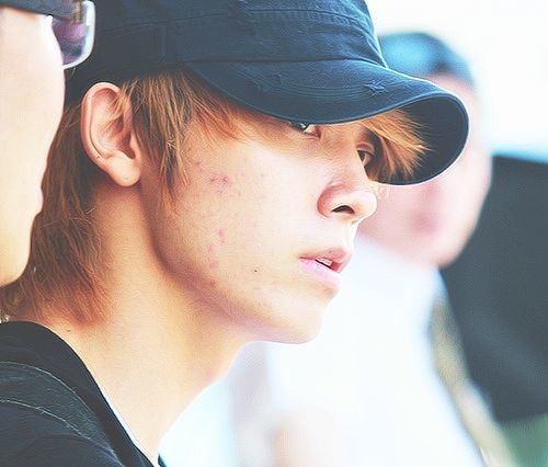 Giật mình khi bắt gặp khuôn mặt đầy mụn của Sao Hàn