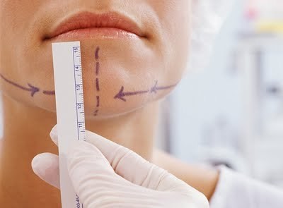 Quá trình Shbet888 tiền thưởng cực khủng độn cằm nhiều nguy hiểm và đau đớn hơn cả nâng mũi.