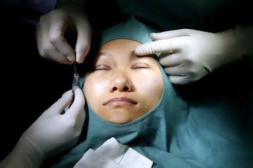 Chi phí của một ca cắt mí mắt khoảng từ 6 - 10 triệu.