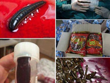 Sự thật ca Shbet888 tiền thưởng cực khủng toàn đỉa trong bụng người tại Bạch Mai