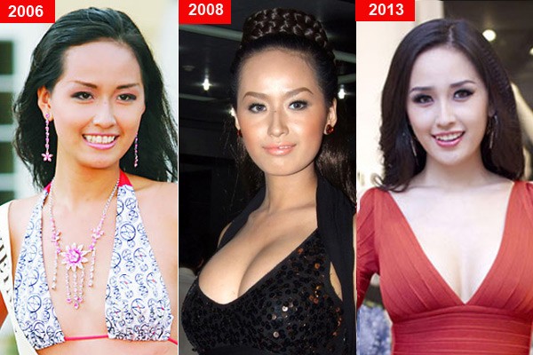 Cô dính đến nhiều nghi vấn dao kéo như: nâng ngực, độn cằm... Cộng với nghệ thuật trang điểm khéo léo và định hướng phong cách đúng đắn giúp cô ngày càng xinh đẹp, quyến rũ hơn.