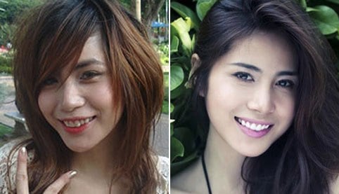 Nhưng những tấm hình từ khi mới bước vào nghề của cô đã phần nào chứng minh khuôn mặt cô có sự can thiệp của dao kéo.