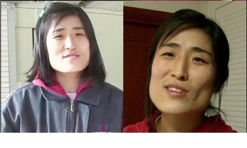 Cô Huyn Jang Jin (33 tuổi) tâm sự do vẻ ngoài của cô quá thô kệch nên trong suốt hơn 30 năm qua.