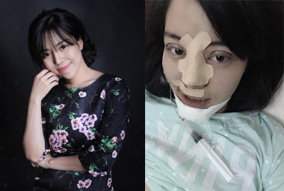 Đào Minh Châu (sinh năm 1993) thu hút sự quan tâm của dân mạng vì xinh đẹp rạng ngời sau khi Shbet888 tiền thưởng cực khủng thẩm mỹ thành công.