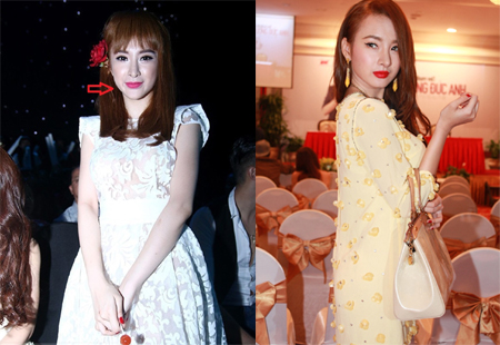 Sốc: Khuôn mặt biến dạng vì thẩm mỹ của Angela Phương Trinh